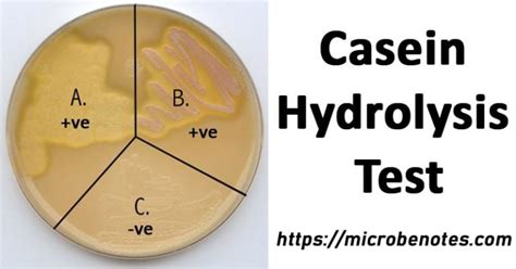 casein hydrolysis test